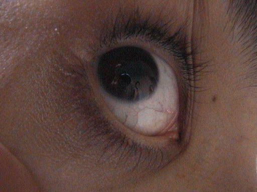 ojo_marcia